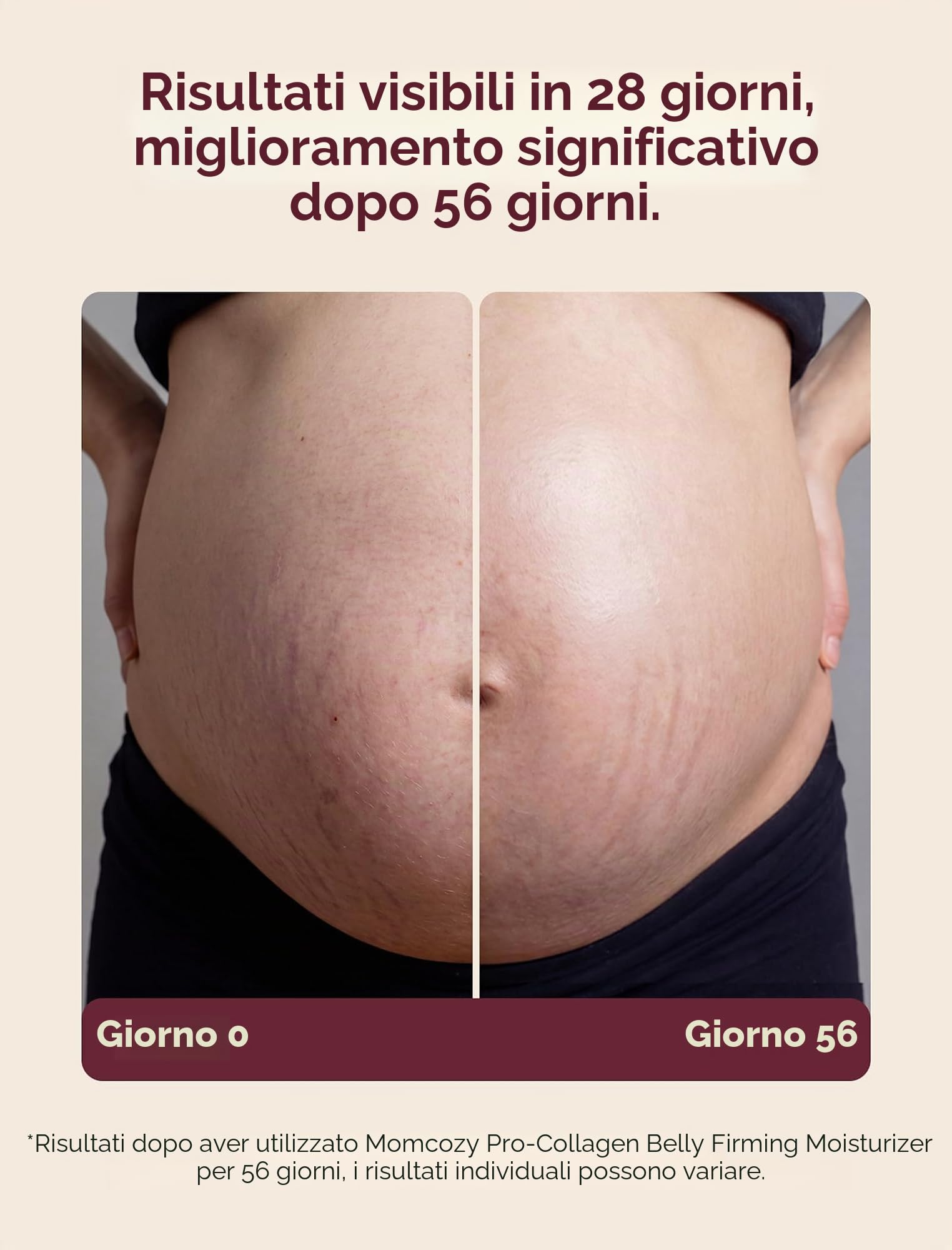 Momcozy Crema Smagliature e Rassodante Pancia 4-in-1,Trattamento con Peptidi Pro-Collagene,Idratante, Rassodante ed Elasticizzante per Gravidanza e Post Parto,150g