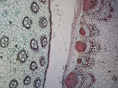 Monocot and Dicot Stem in Comparision - Microscope Slide