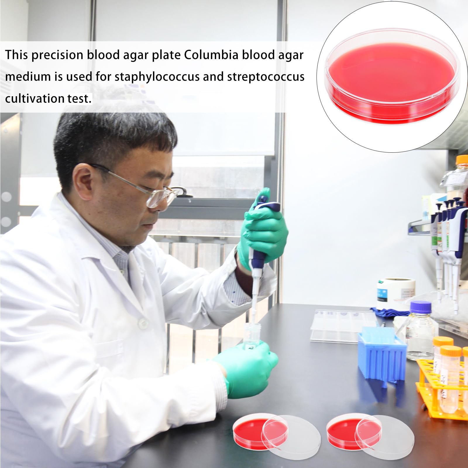 SECFOU 10 Placas de Agar con Hemoglobina para Laboratorio Cultivo Rojo, Material Pe, Precisión Moldeada para Uso Industrial Instituciones Médicas