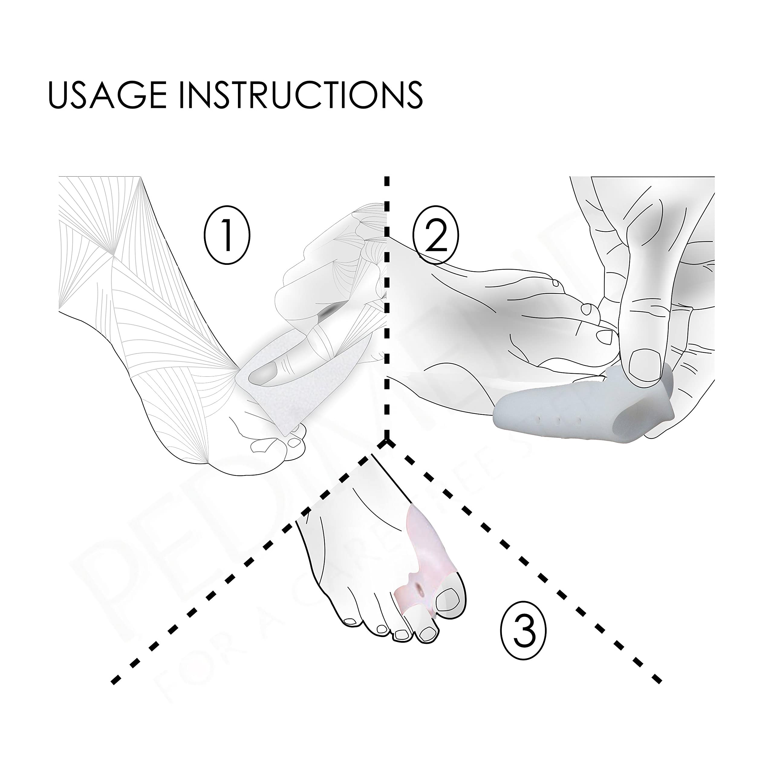 4 x Pedimend Gel-Zehenkeile für Ballenzehe, Zehenspreizer aus Silikon, für große Zehen, Hallux Valgus Korrektur-Pad, Schmerzlinderung