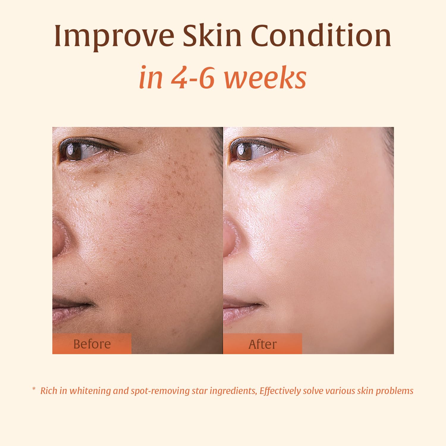 Turmeric Kojic Acid Soap – Hand-made Soap, Dark Spot Remover for Face & Body, Skin Brightening, Even Tone, Moisturizing with Collagen, Retinol, Vitamin E, Shea Butter & Hyaluronic Acid – 2 Bars - Image 4