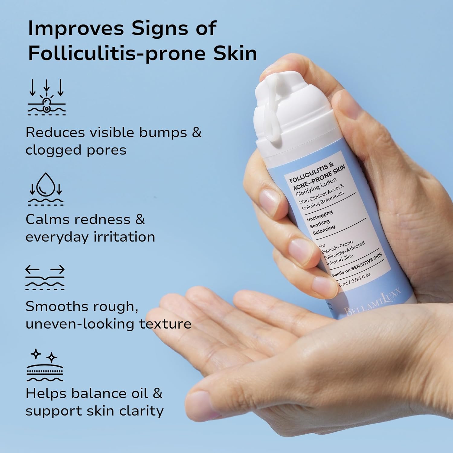 2-Step Folliculitis Acne Lotion for Body: Helps Reduce Itch, Redness, Body Acne & Uneven Texture with Salicylic & Glycolic Acid + Botanicals - Gentle Care for Folliculitis-Prone Skin