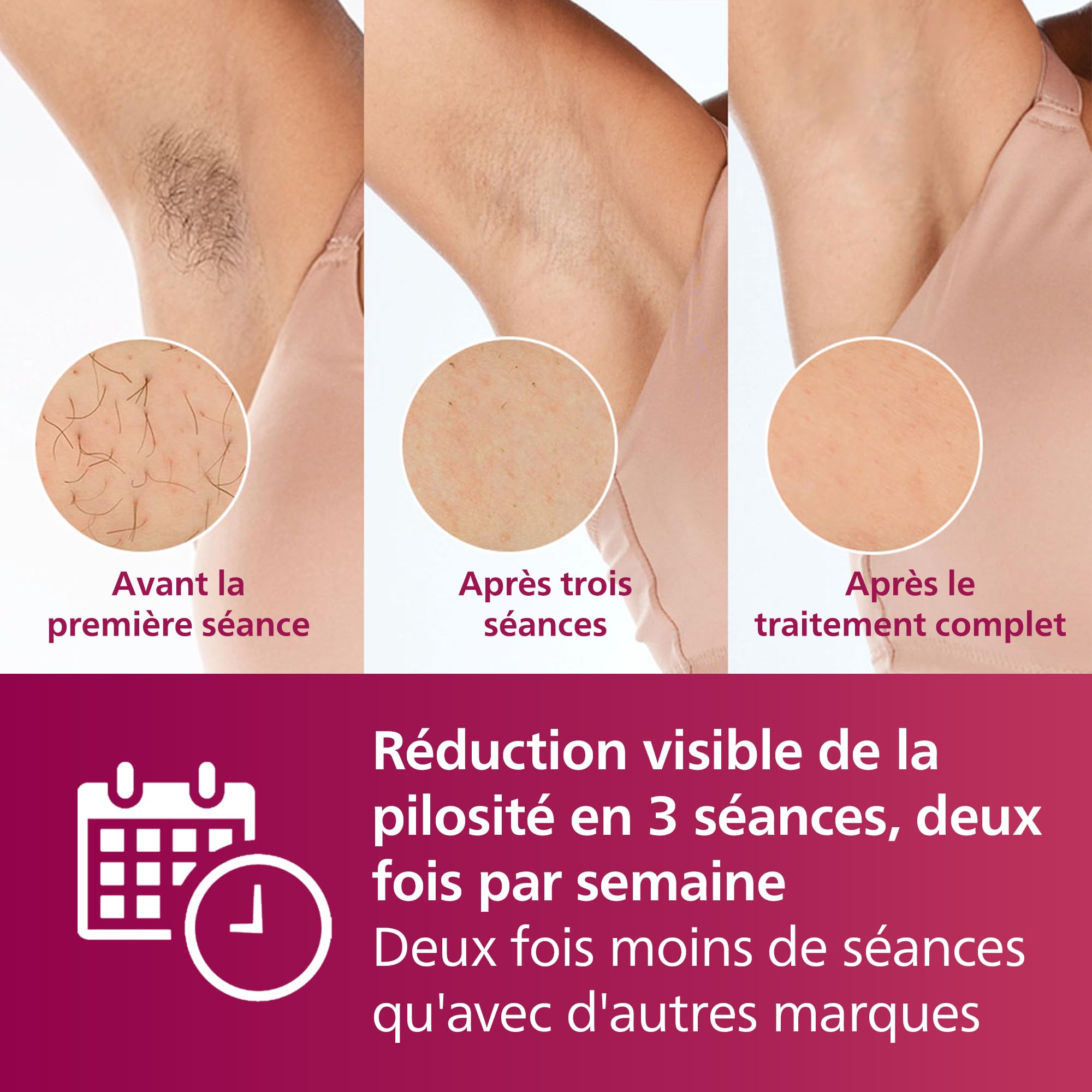 Philips Lumea série 7000, Épilateur à lumière pulsée, alternative à l'épilation laser, 3 embouts pour le corps, le visage et le maillot, modèle SC1999/00 - 4