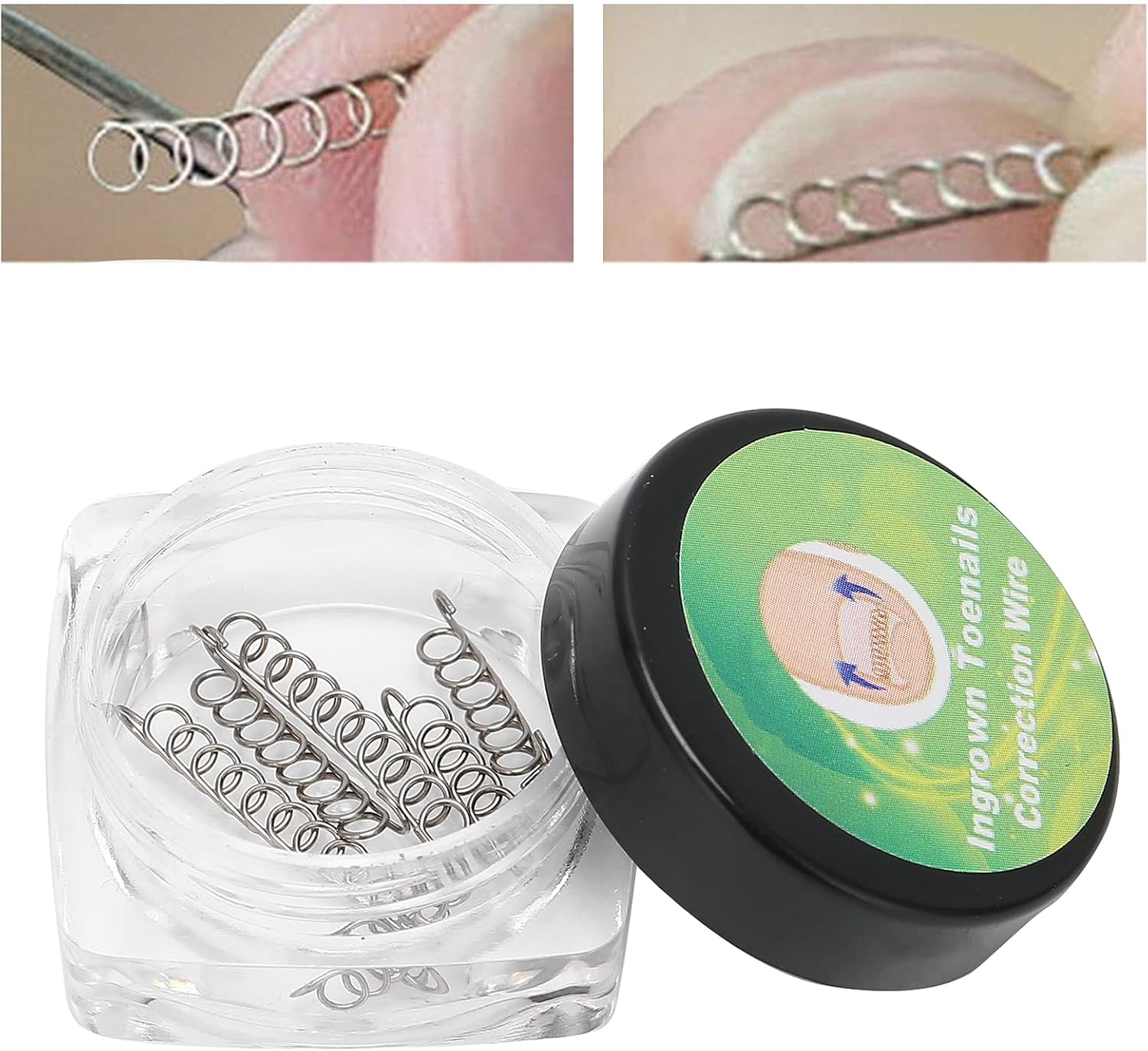 FILFEEL Ingrown Toenail Corrector Kit, Stainless Steel Wire, 6 Sizes