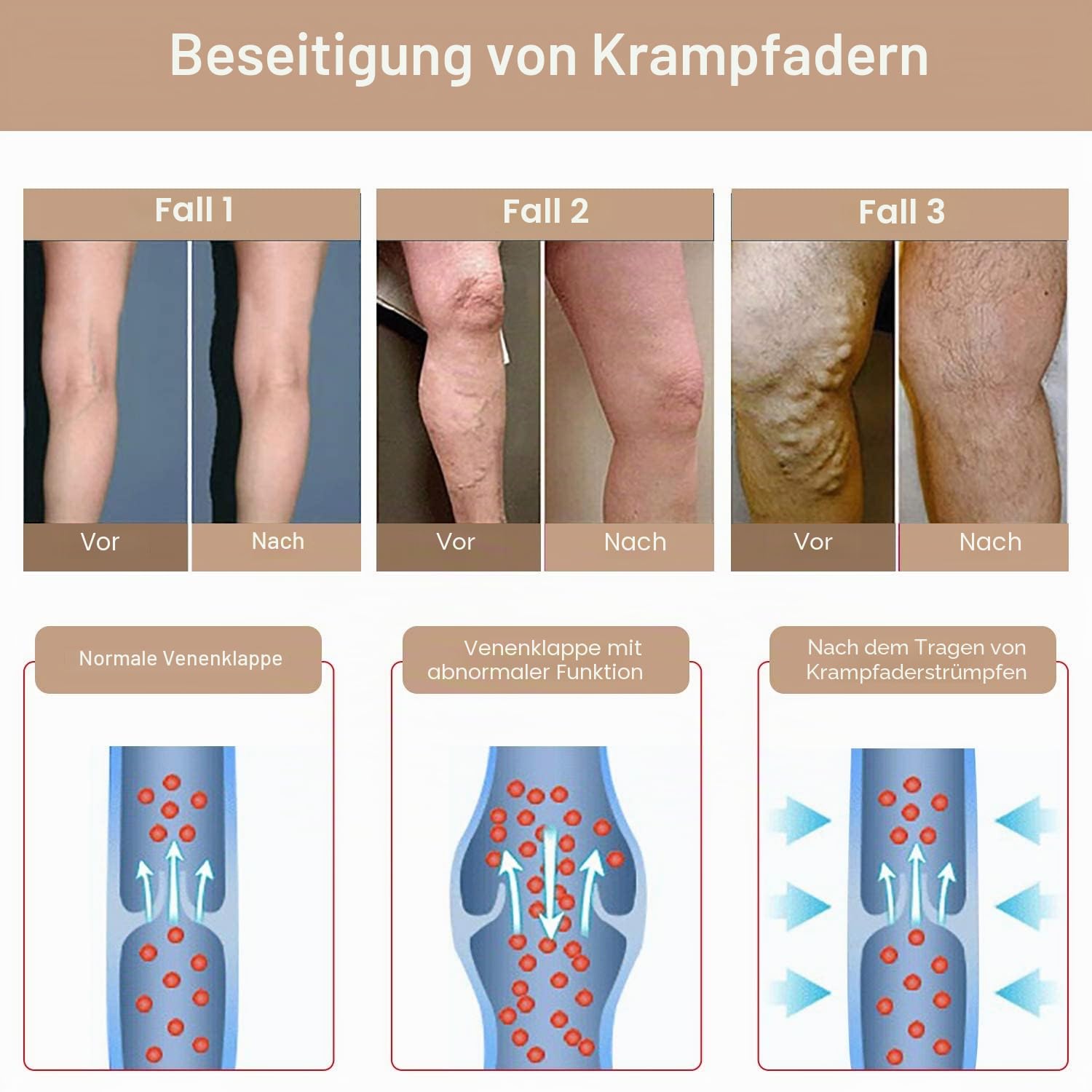 YISEMEYA 2 Paar Medizinische Kompressionsstrümpfe Damen Lang,20-30 mmHg Stützstrümpfe Herren, Hohe Taille Undurchsichtig Zehenwickel Kompressionshose klasse 2​Unterstützung für Krampfadern,Ödeme