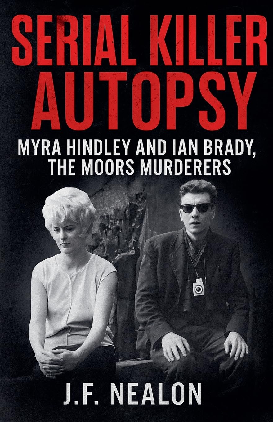 Serial Killer Autopsy: Myra Hindley and Ian Brady: 23
