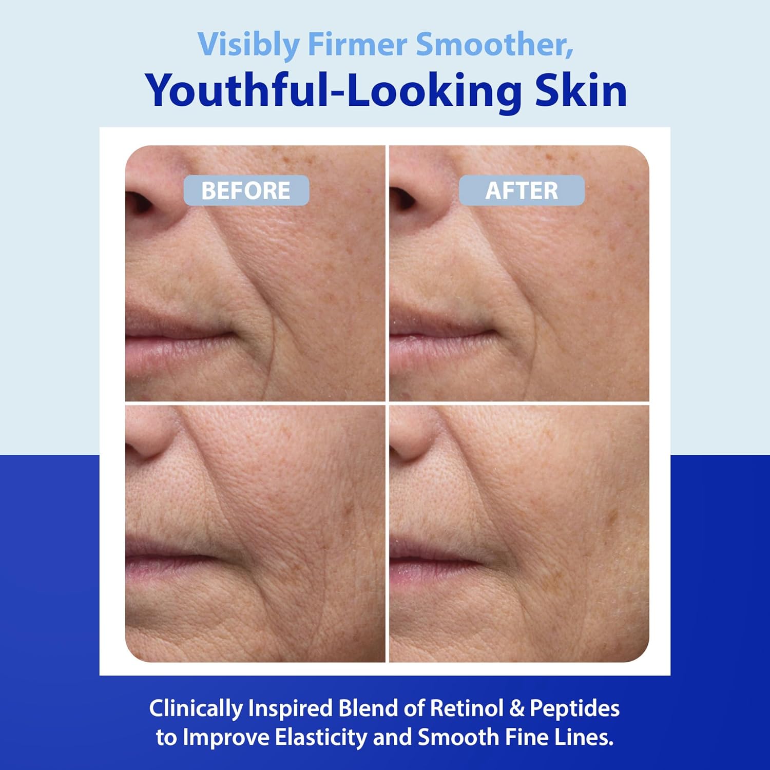 Dr. Denese HydroShield Dream Cream 1.7 oz – Advanced Moisturizer with Ceramides, Retinol and Peptides for Smooth Radiant Skin, Improved Elasticity and Deep Hydration – Doctor Developed, Cruelty Free - Image 6