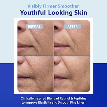 Dr. Denese HydroShield Dream Cream 1.7 oz Advanced Moisturizer with Ceramides, Retinol and Peptides for Smooth Radiant Skin, Improved Elasticity and Deep Hydration Doctor Developed, Cruelty Free