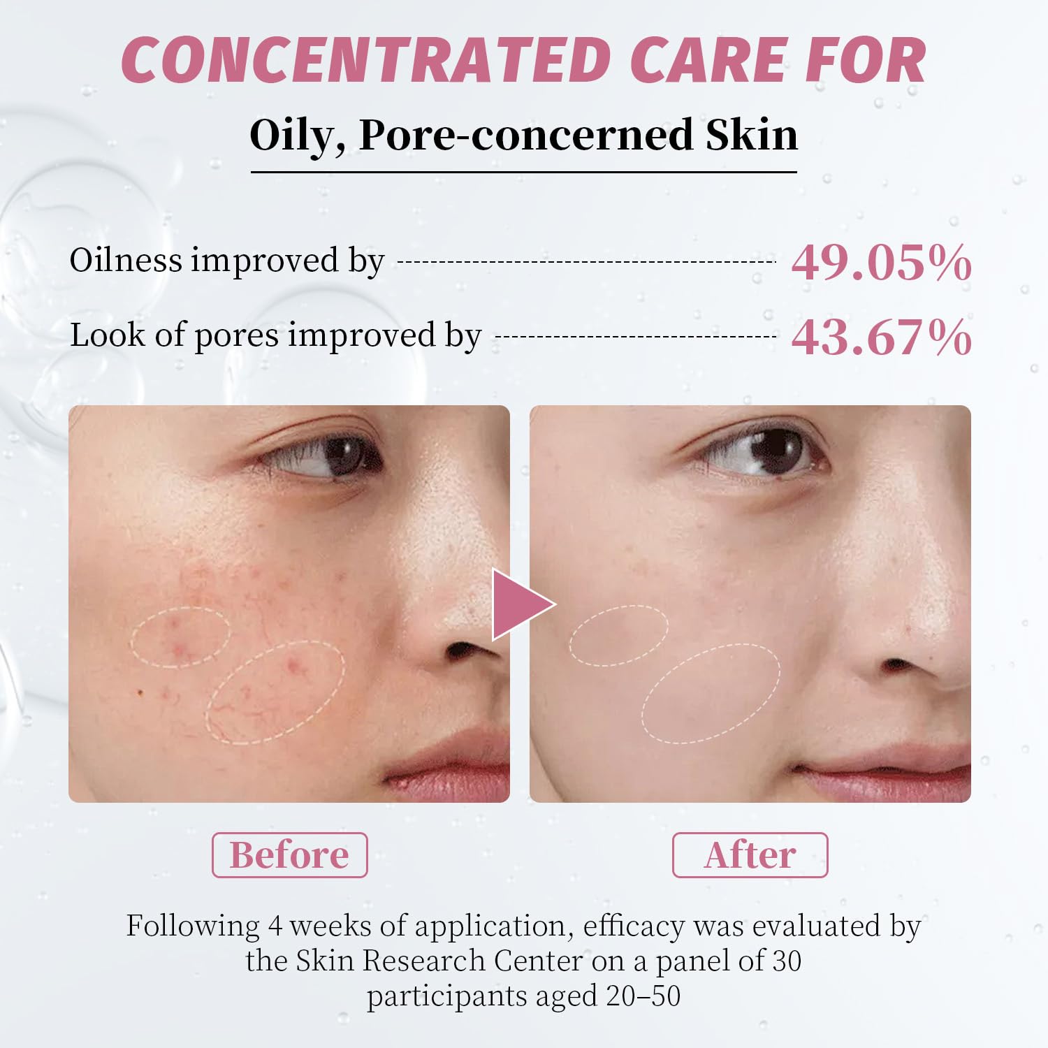 Niacinamide Serum 10% + Zinc 2% – Brightening Face Serum with Hyaluronic Acid & Arbutin for Nourished, Balanced, Blemish - Prone Skin 30ml / 1 fl oz - Image 4