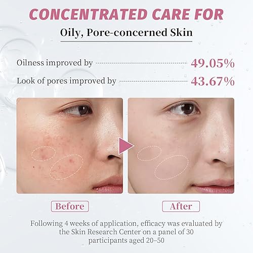 Miniatura 4 de Suero de niacinamida 10% + zinc 2%  Suero facial iluminador con ácido hialurónico y arbutina para piel nutrida, equilibrada y propensa  1 onza