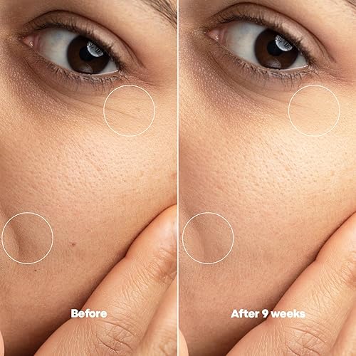 Miniatura 8 de Suero hidratante de ácido hialurónico al 2%  Humedad profunda, mejora la elasticidad de la piel, repara la barrera cutánea, reduce las líneas finas,