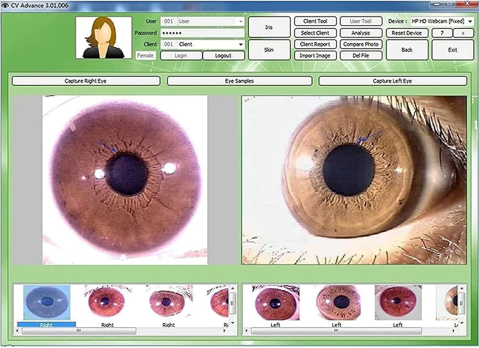 診断革命　虹彩診断による治療　東洋虹彩分析 虹彩について - デッドシースパ日本初の老舗サロン - kibbnet(キブネット)