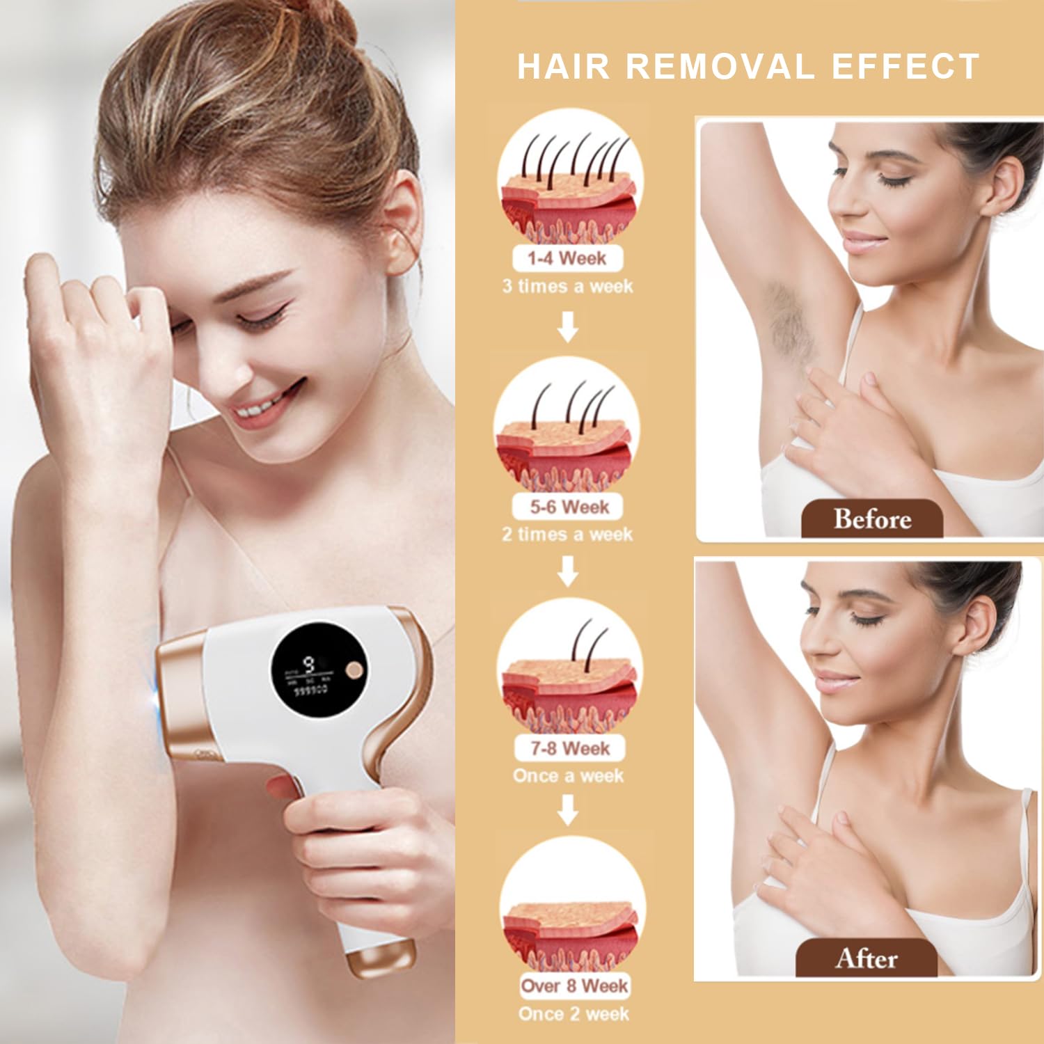 IPL-Laser-Haarentfernungsgerät für Frauen & Männer, 3-in-1 Dauerhafte Haarentfernung mit 9 Energieleveln, 999.000 Blitzen, Schmerzfrei & Effektiv für Gesicht, Körper, Bikinizone, Beine und Achseln