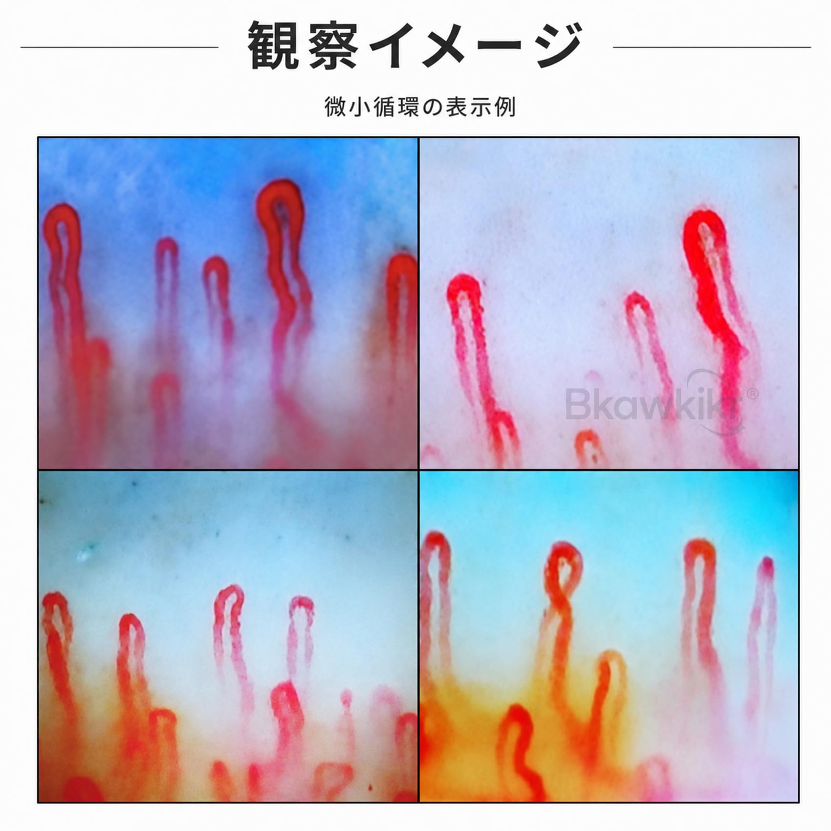 Amazon.co.jp: 血流スコープ 毛細血管顕微鏡 微小循環観察用 モニター