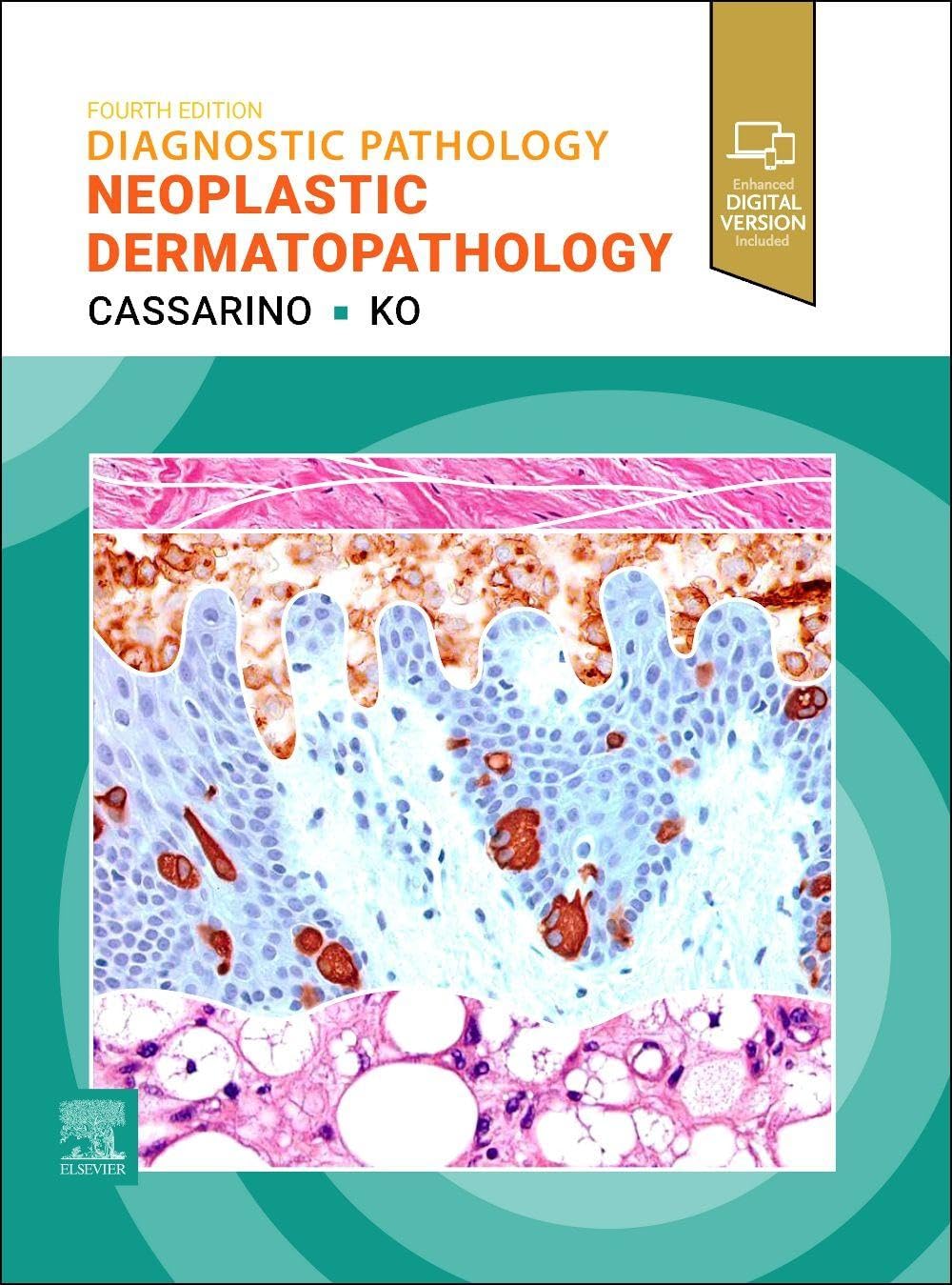 Diagnostic Pathology: Neoplastic Dermatopathology by David S.... - 9780443410369