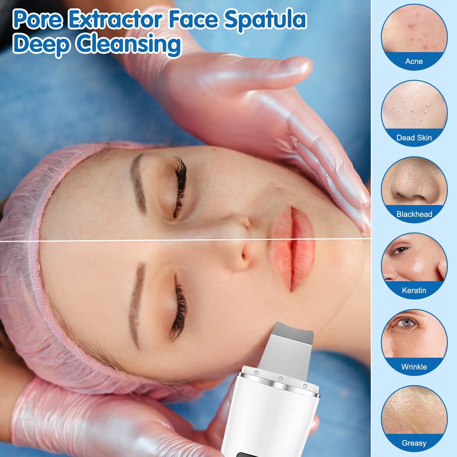 Face Scrubber Skin Spatula-2024 New Blackhead Remover Pore Cleaner,Pore Extractor Face Spatula Deep Cleaning for Facial Skin Care Women Gift(White)