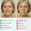 Denture Set, Silicone, Denture, Supervised by a Dentist, Adjustable, Comfortable Fit, Instant Denture, Eating and Drinking, Top and Bottom Set, Easy to Put on and Take Off, Durable, Reusable