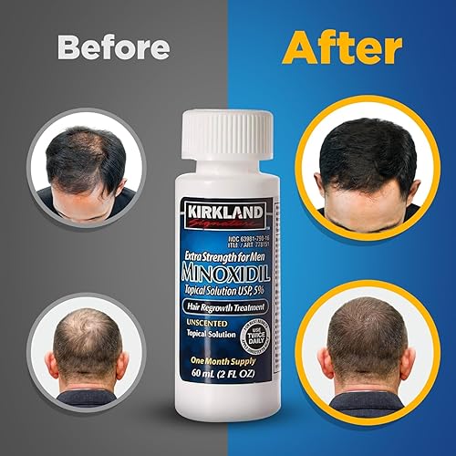 Miniatura 2 de Kirkland Signature 5% Minoxidil crecimiento del cabello para hombres - 1 mes de suministro