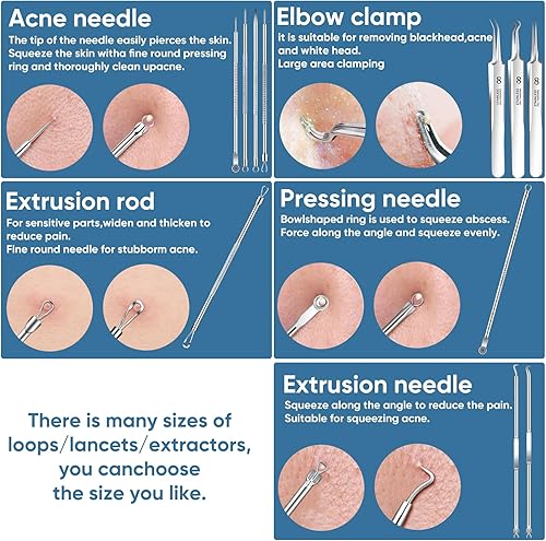 Miniatura 3 de Kit de herramientas para eliminar puntos negros, herramienta extractora de espinillas, herramienta extractora de espinillas, herramienta profesional