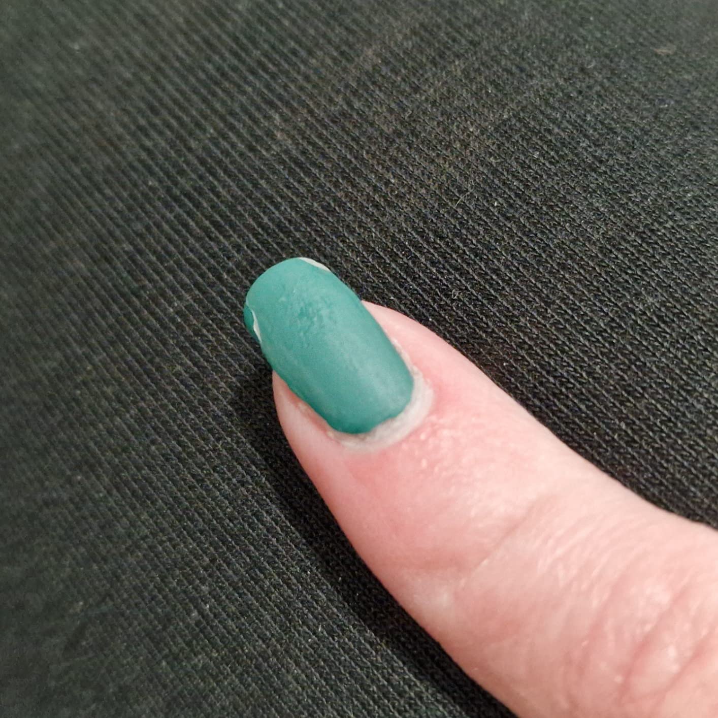 Erschreckend schlechte Qualität