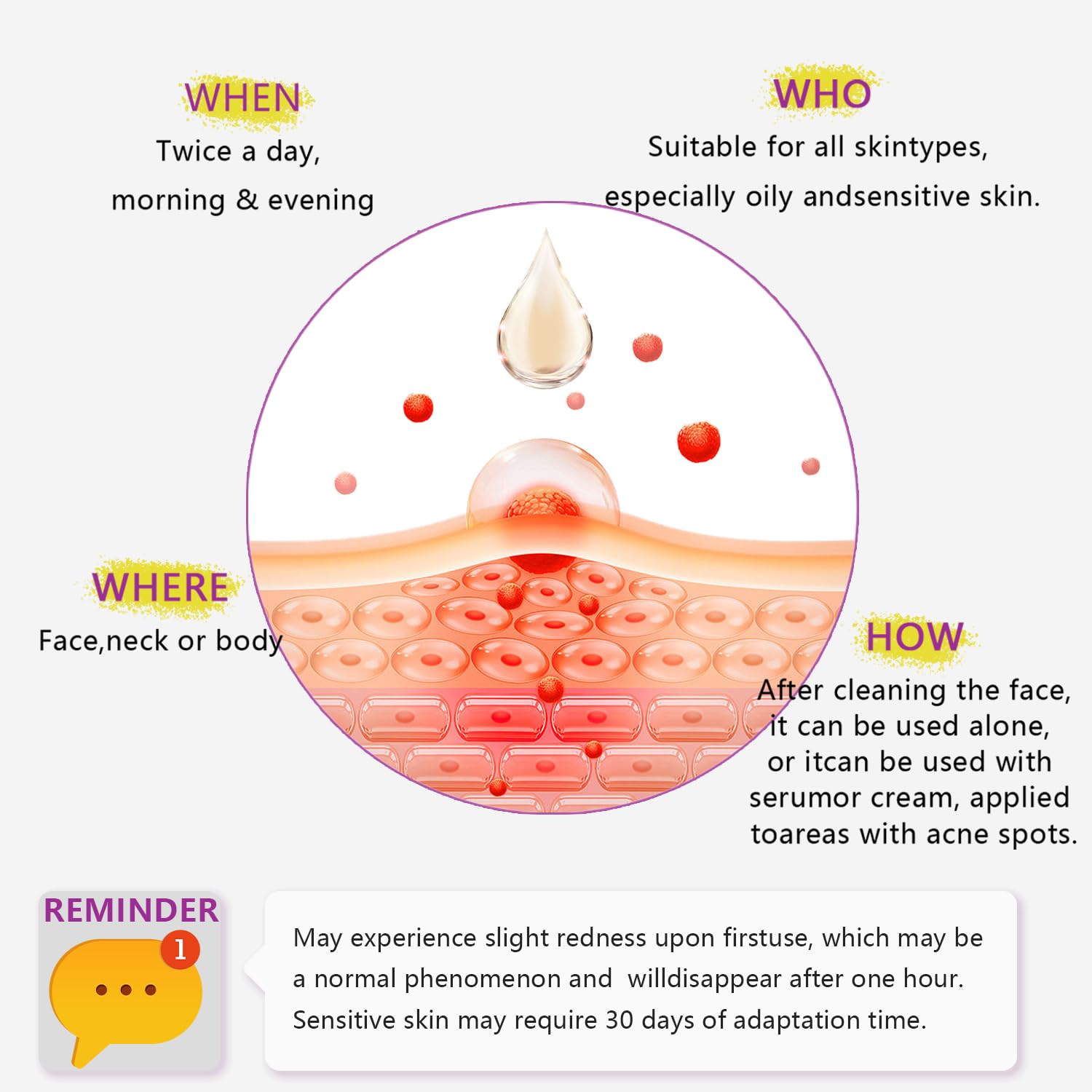 Azelaic Acid, 12% Azelaic Acid For Face Serum Rich in Niacinamide and Hyaluronic Acid, Fades Post Acne Marks and Calms Redness, Formula for Uneven and Blemish Prone Skin Care