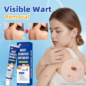 Skin Tag Remover: compound w wart remover & genital wart remover (1-Pack)