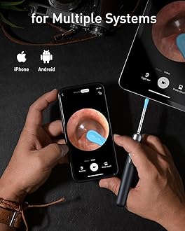Ear Wax Removal, 3 in 1 Earwax Removal Kit, 1080P HD Ear Cleaner with Camera, FSA HSA Eligible, Otoscope with 7 Ear Spoon, Ear Cleaning 6 LED Lights 15 Ear Tips, Ear Camera for iOS & Android