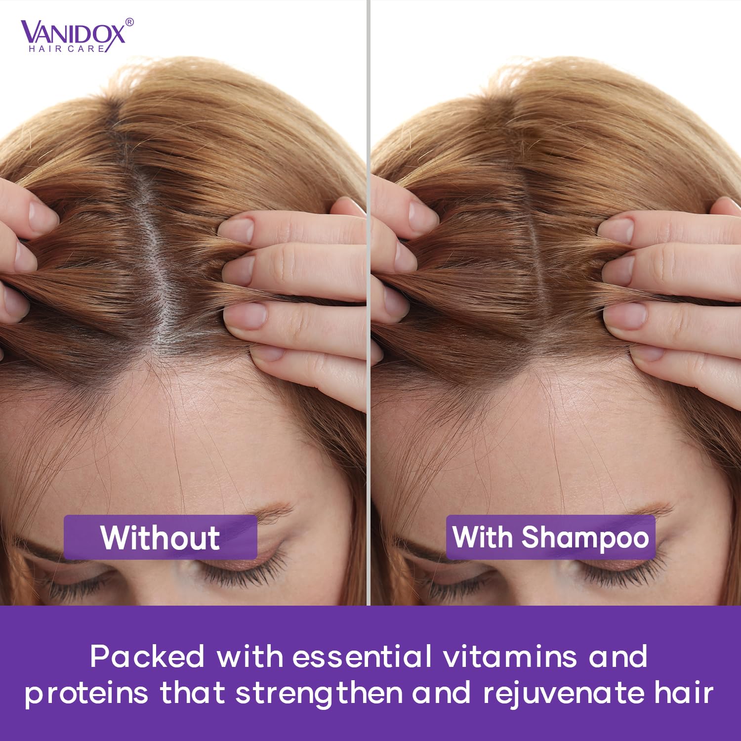 Tea Tree Shampoo and Conditioner Set with Lavender and Mint | DHT Blockers | With 100% Pure Tea Tree Oil for Itchy, Dry Scalp | Sulfate & Paraben Free | For Men & Women | 16 fl oz Each - Image 7