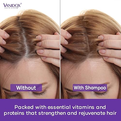 Miniatura 7 de Juego de champú y acondicionador de árbol de té con lavanda y menta  Bloqueadores de DHT  Con aceite de árbol de té 100% puro para picazón y cuero