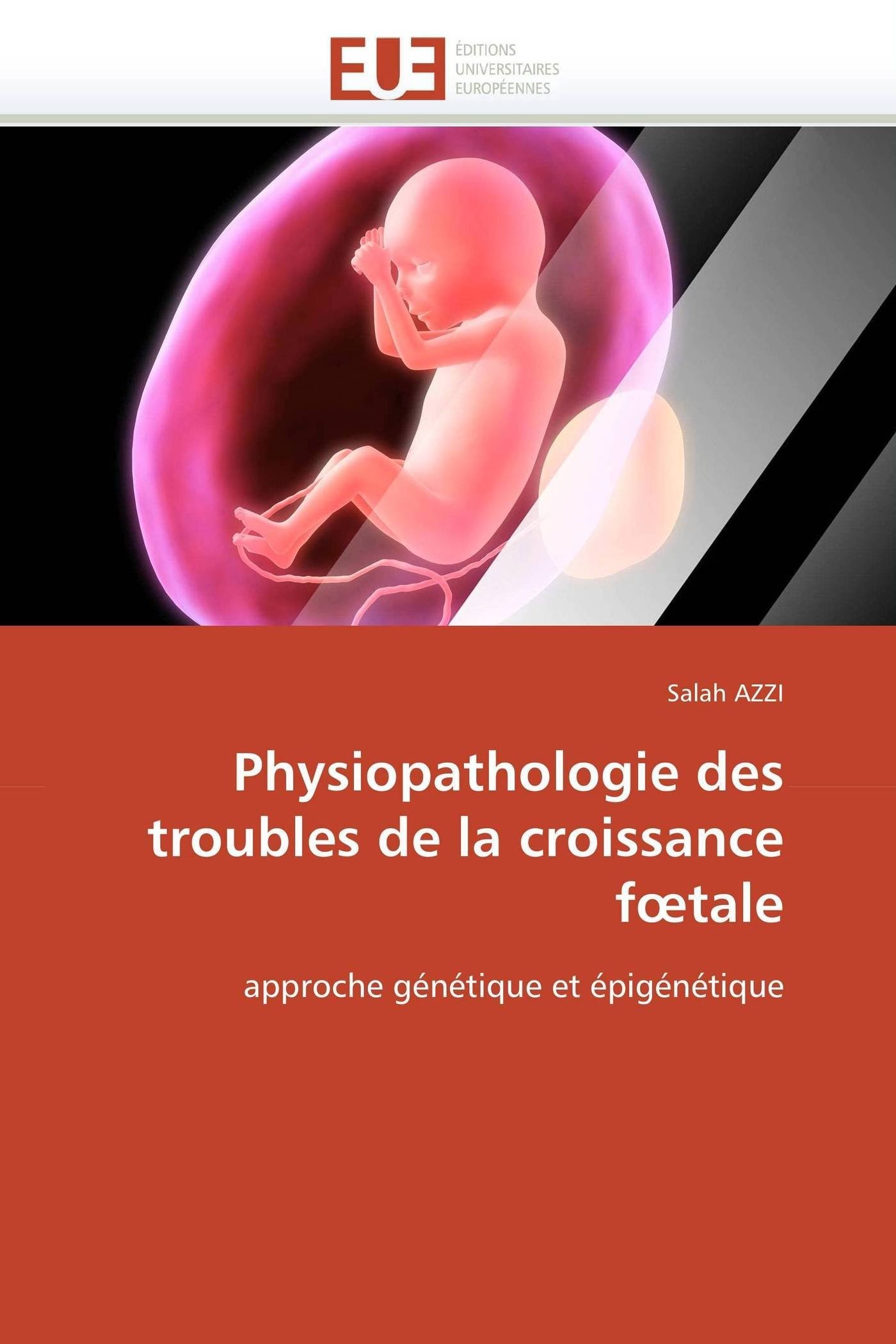 Physiopathologie des troubles de la croissance fœtale: approche génétique et épigénétique (Omn.Univ.Europ.)