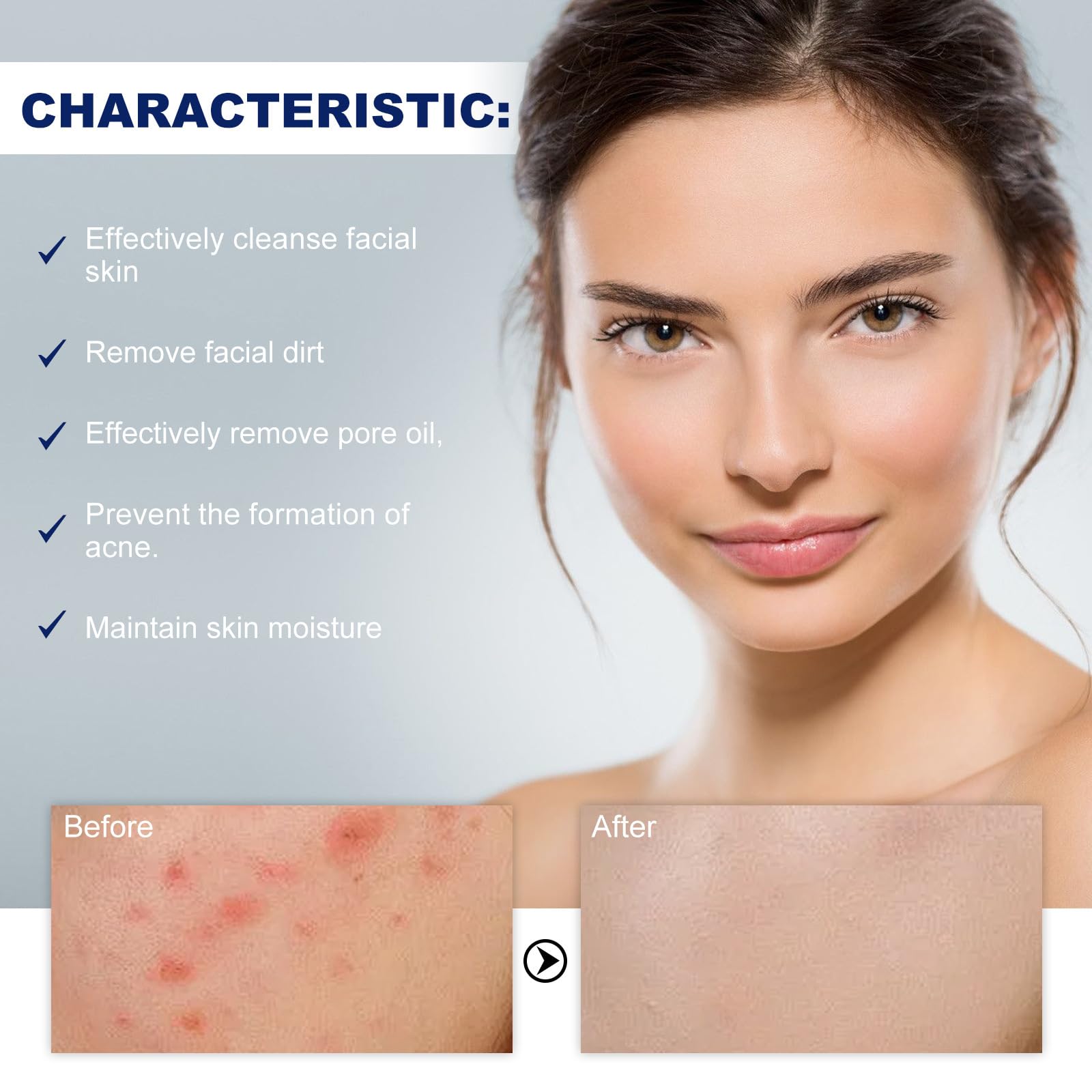 Acne Foaming Wash pianka do mycia trądziku, pianka do oczyszczania twarzy, kojąca pianka do codziennego czyszczenia skóry twarzy
