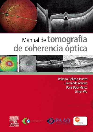 Manual de tomografía de coherencia óptica