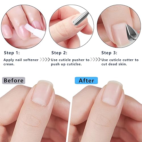 Miniatura 5 de Cortacutículas con empujador de cutículas y tijeras, removedor de cutículas, herramientas profesionales duraderas de pedicura y manicura, cortador
