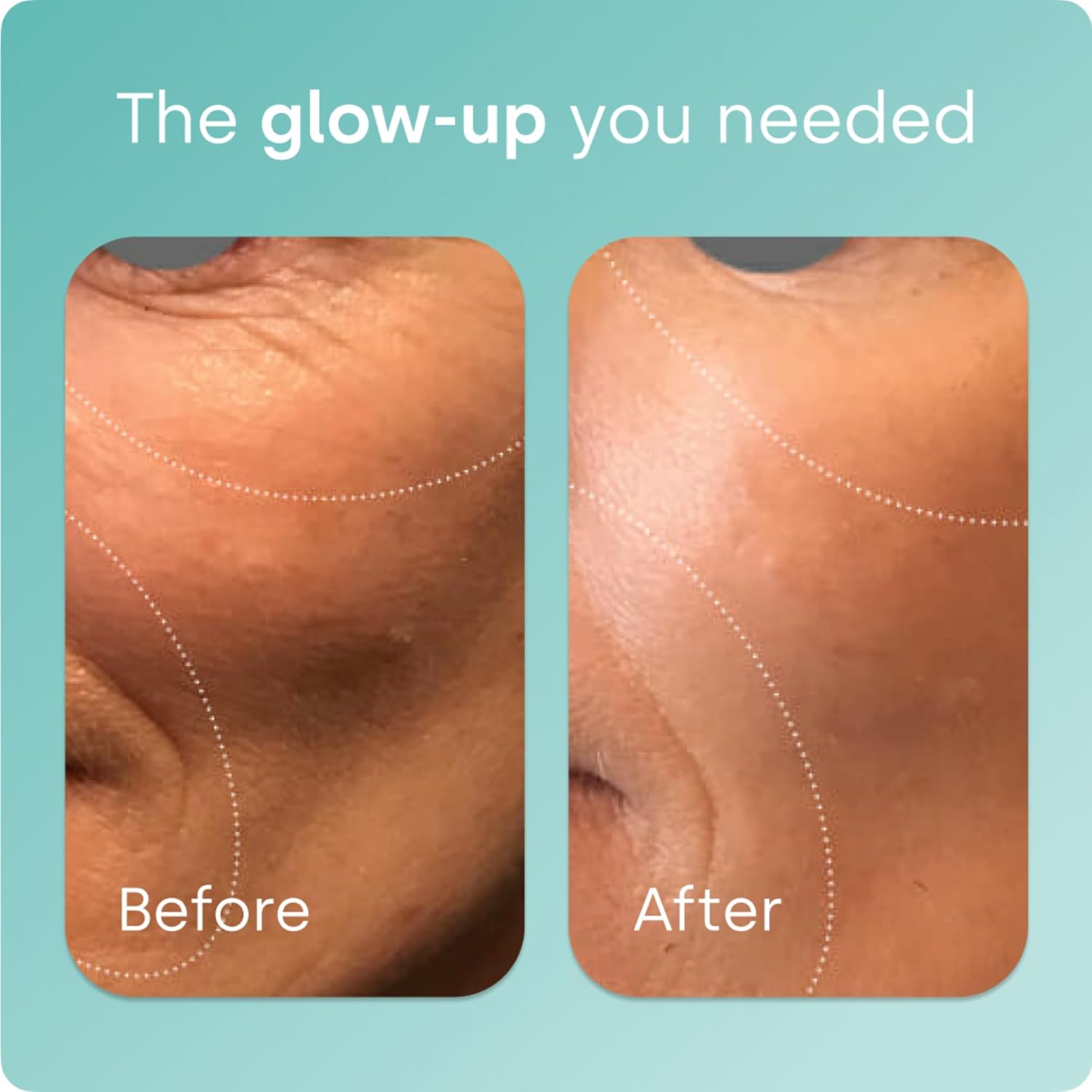 Biosil Collagen Booster Supplement - 120 Original Capsules - Patented ch-OSA Activator for Skin, Hair, Nails & Joints - Supports Natural Production - 60-Day Supply - Image 3