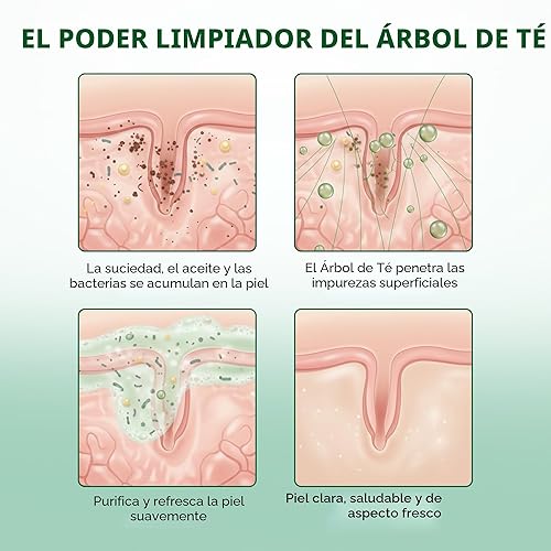 Miniatura 6 de Botanic Hearth Gel de baño de árbol de té, ayuda con uñas, pie de atleta, tiña, picor de tiña, acné, eccema y olor, alivia la picazón, promueve