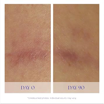 iS CLINICAL Super Serum Advance+, Anti-Aging Vitamin C Face Serum, reduces scaring and fine stretch marks, 0.5 Fl Oz