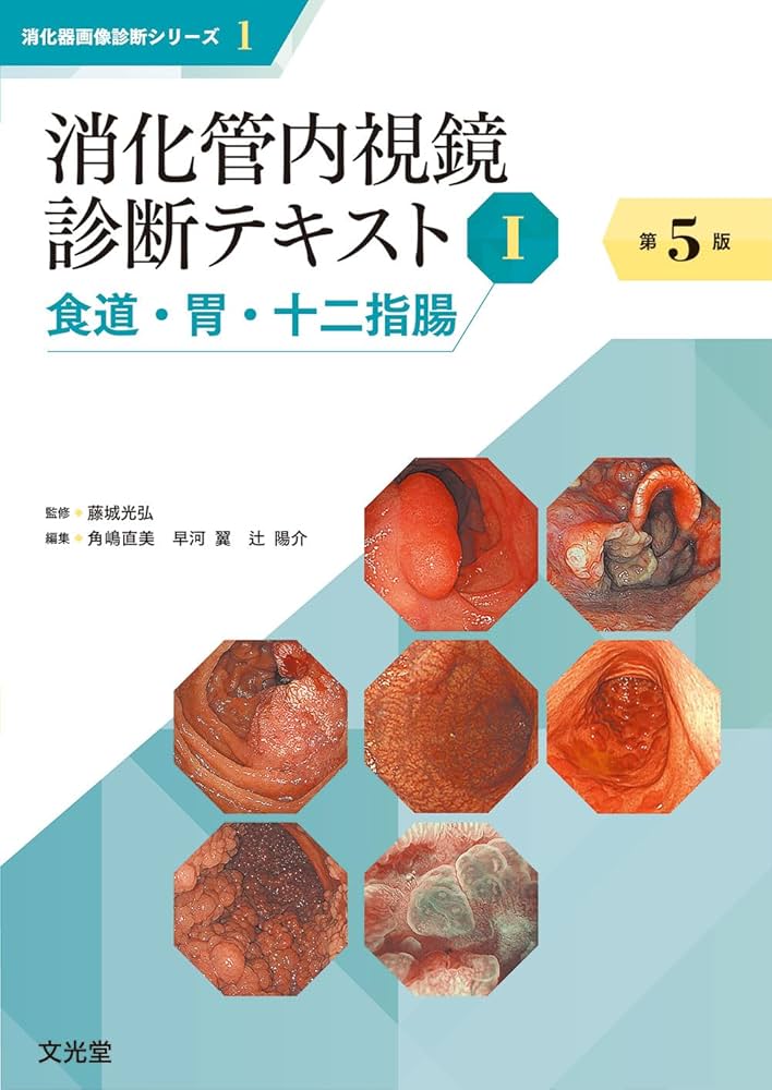 消化管内視鏡診断テキスト Ⅰ 消化管内視鏡診断テキスト I 食道・胃・十二指腸 第5版 (消化器画像