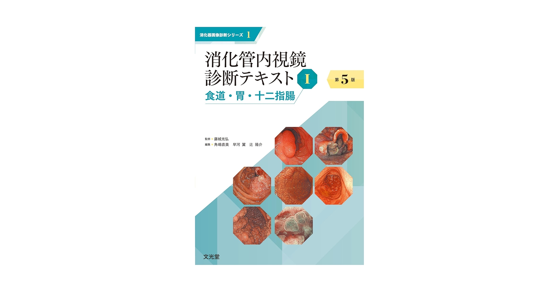 消化管内視鏡診断テキスト ⅠとII 消化管内視鏡診断テキスト ⅠとII 消化管内視鏡診断テキスト Ⅰ