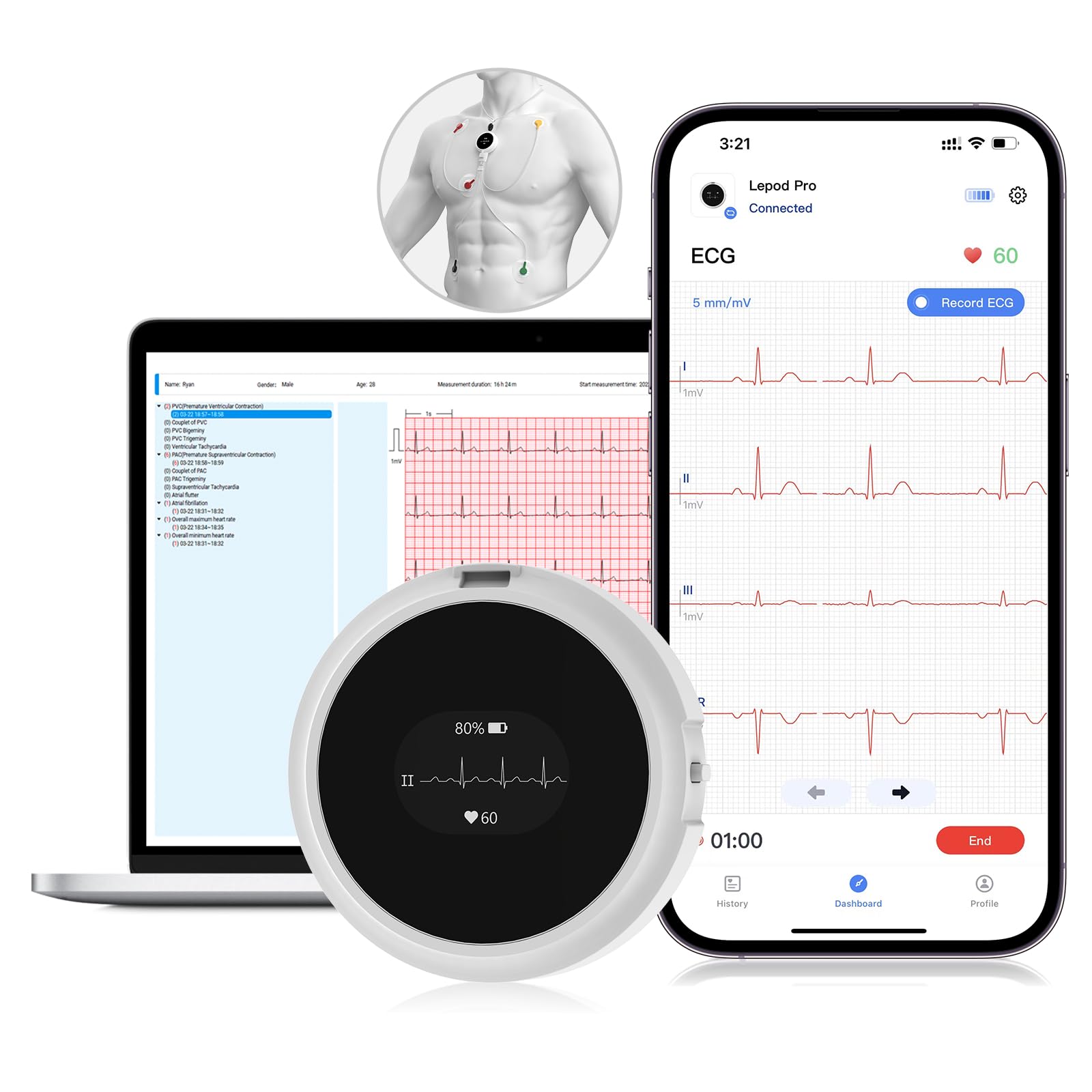 CheckMe LepodPro Monitor ECG a 7 derivazioni, registrazione ECG in tempo reale per 24 ore, report ECG AI dettagliati, marcatori di eventi, durata della batteria di 72 ore, supporto per smartphone e PC