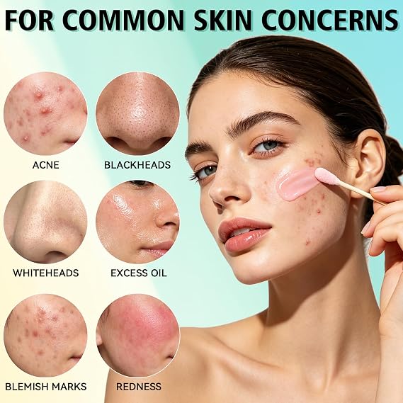 Acne Treatment Serum, Powerful Spot Treatment for Face, Drying Lotion, Face Serum for Acne and Blemishes, Reduces Excess Oil, Especially for Acne Prone and Oily Skin