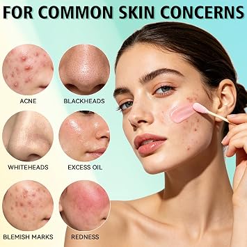 Acne Treatment Serum, Powerful Spot Treatment for Face, Drying Lotion, Face Serum for Acne and Blemishes, Reduces Excess Oil, Especially for Acne Prone and Oily Skin