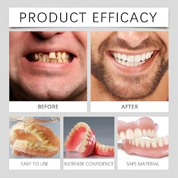 Silicone Denture Reline Set,Silicone Reline Denture Set for Women,Advanced Full Denture Kit Teeth Top and Bottom,Soft Dentures False Teeth Set,Temporary Tooth,Silicone Denture Set,Teeth Veneers