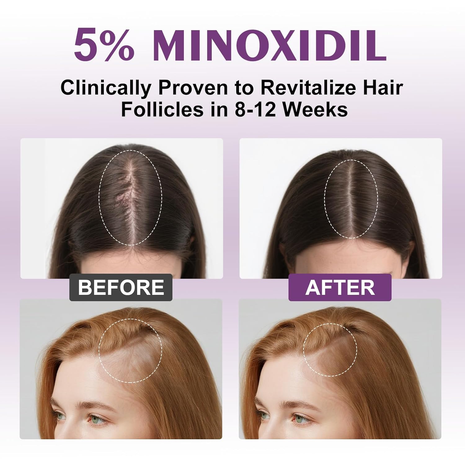 5% Minoxidil Spray for Women-4 PCS ，monoxide for men hair Infused with Biotin, hers hair regrowth treatment, Supports Thicker and Fuller Hair & Beard (13oz, 7 Month Supply) - Image 2