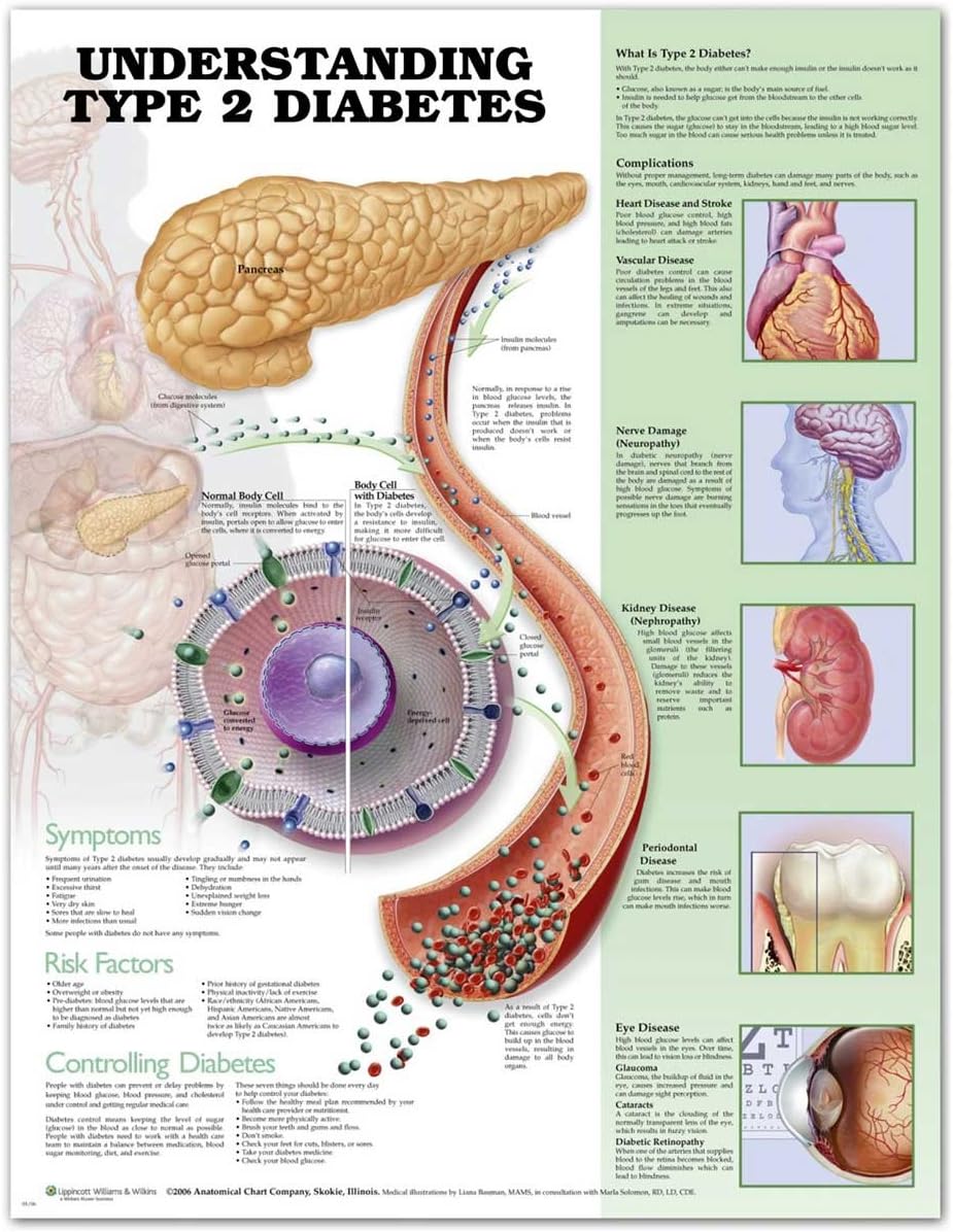Understanding Type 2 Diabetes Anatomical Chart