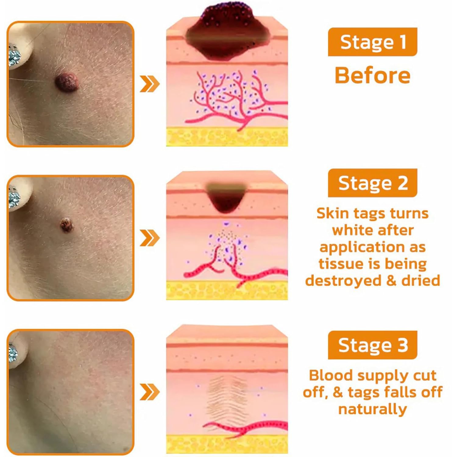 AllyBee Bee Venom Skin Treatment cream,Bee Venom skin Restoration Cream,Improves skin and deeply moisturizes (1PC) - Image 6