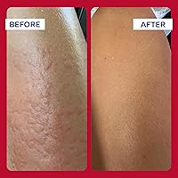 Vista 7 de Pomada de primeros auxilios, Emuaid Max, de 2 onzas, 2, 1