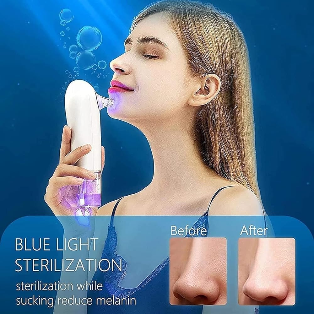 Blackhead Remover Pore Vacuum | Electric Small Bubble Water Cycle Suction Tool | USB Rechargeable Acne Comedo Extractor for Facial Skin Care | Ideal Gift