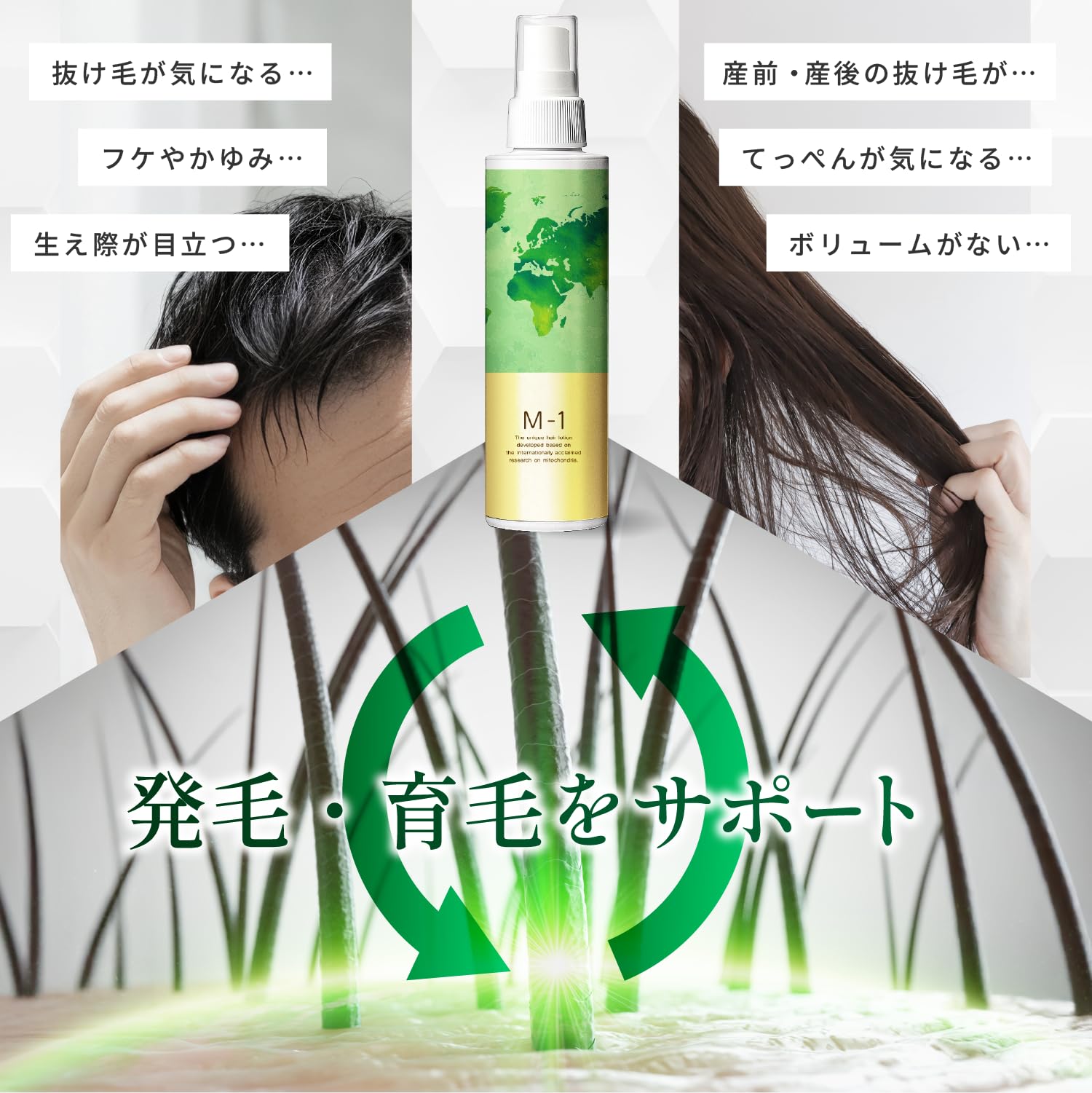 Amazon | 【M-1】育毛剤 エムワン 200ml 男性用 女性用 男女兼用 医薬
