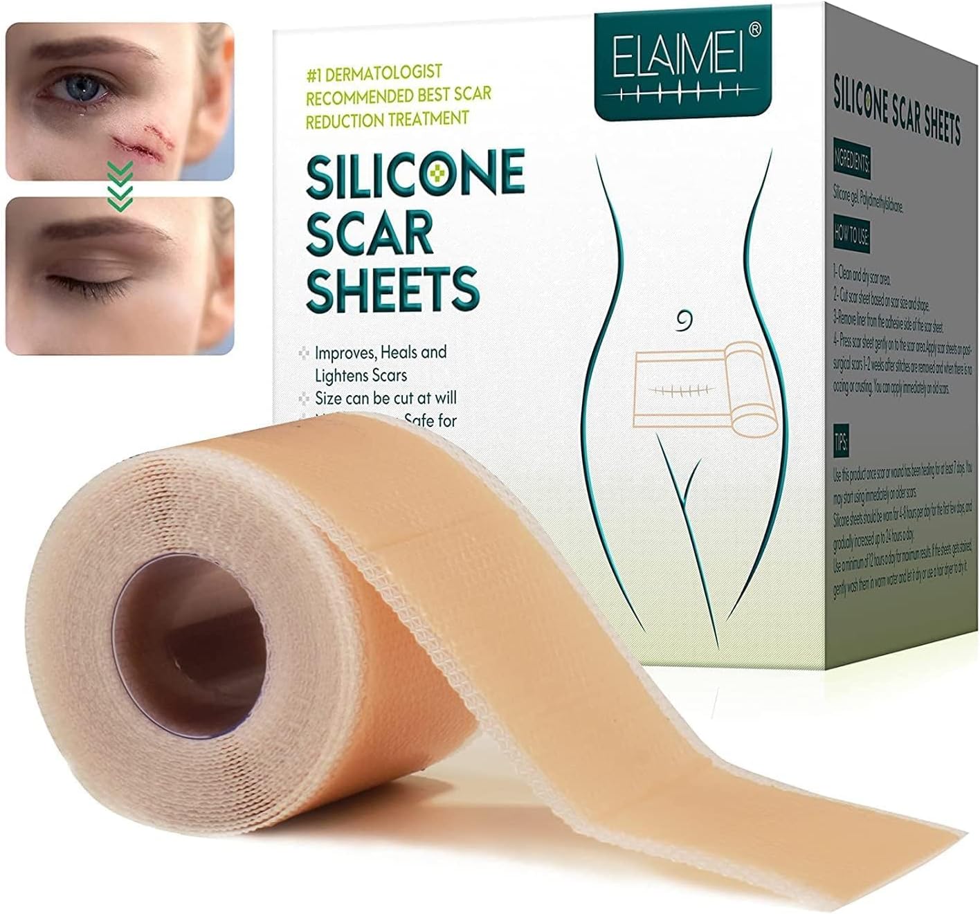 DD Silicone Scar Sheets, Silicon Gel Sheets for Scars Transparent Medical Silicone Gel Tape for Scar Removal, Silicone Scar Tape Roll for Hypertrophic Scars and Keloids Caused by Surgery