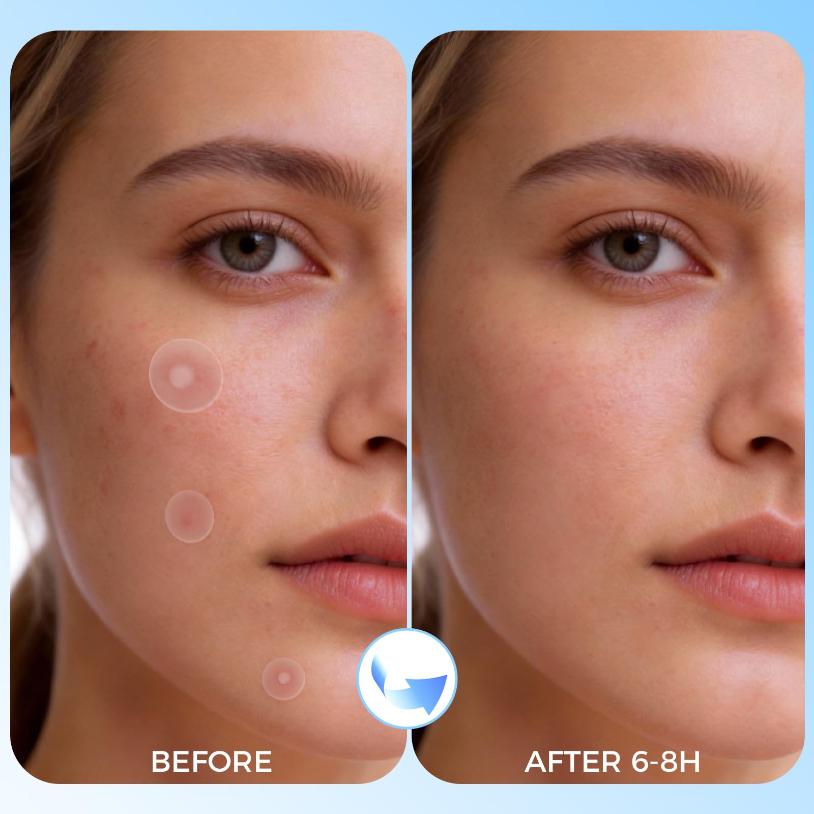 Pimple Patches for Face, 640 Count Hydrocolloid Acne Patches for Face, 4 Sizes Zit Patch for Covering, Blemishes and Breakouts, Dots Stickers with Salicylic Acid, Tea Tree Oil & Calendula Oil - 5